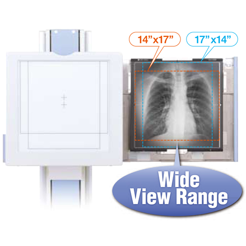   Wireless digital radiography X-ray machine system AeroDR 17x17 inch flat panel detector